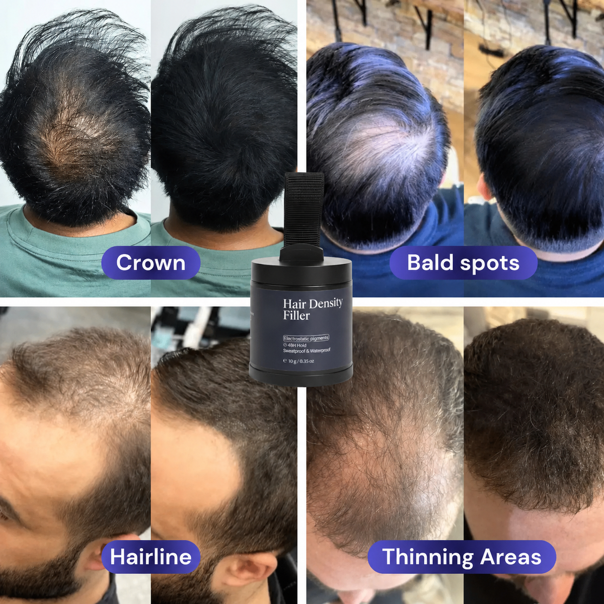 Hair Density Filler