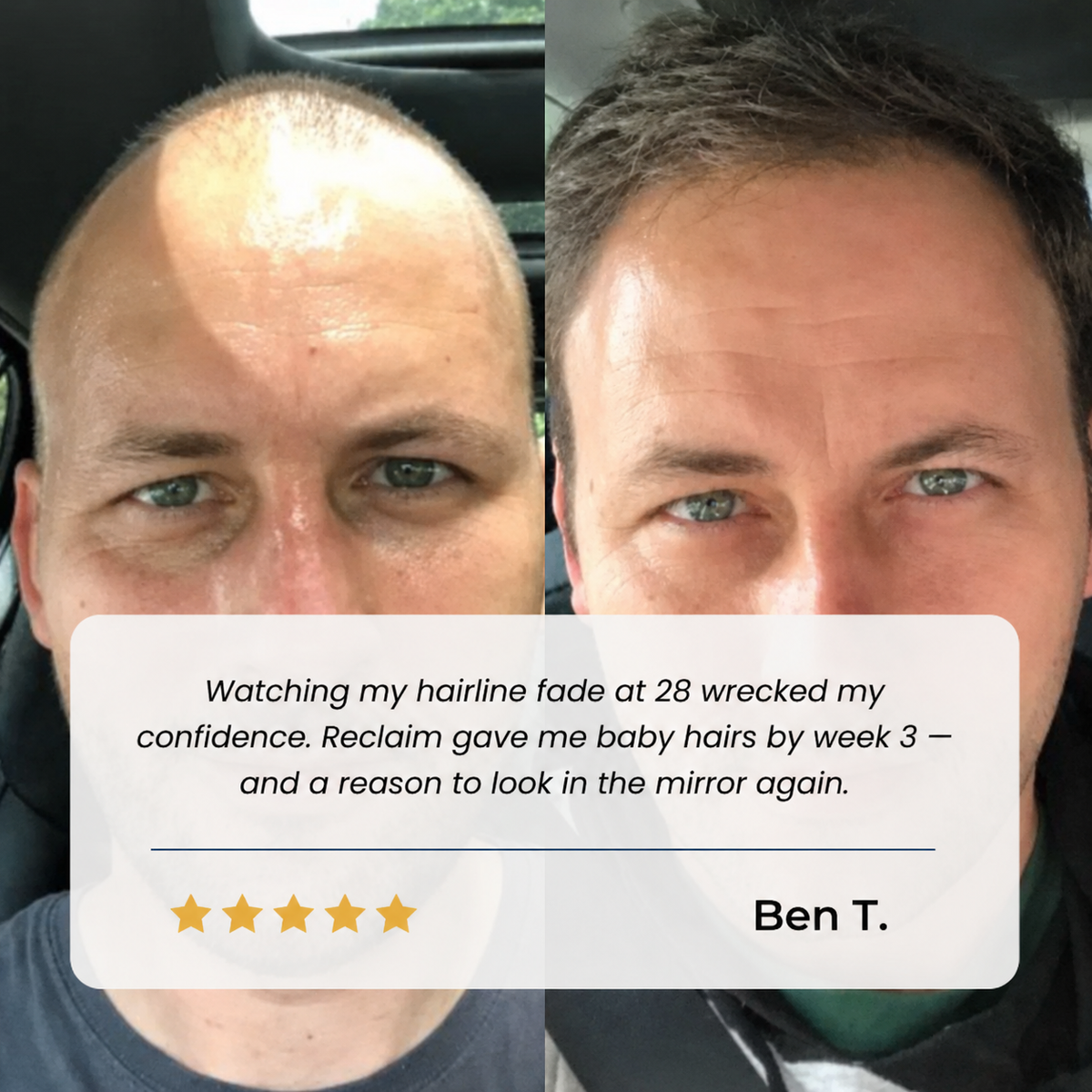 Hair Growth Roll