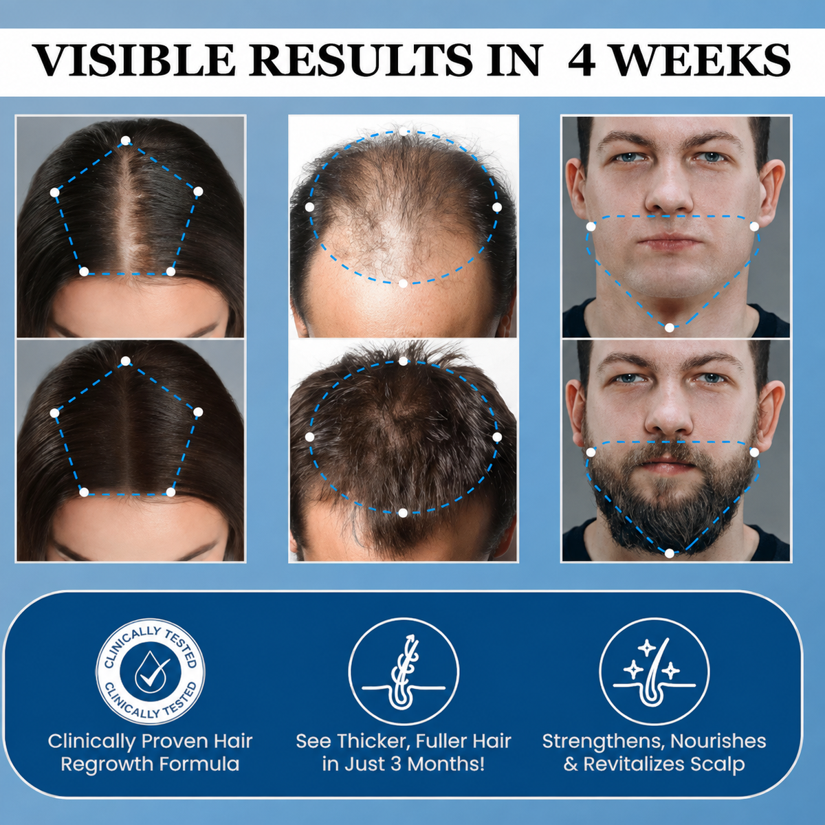 Hair Growth Roll