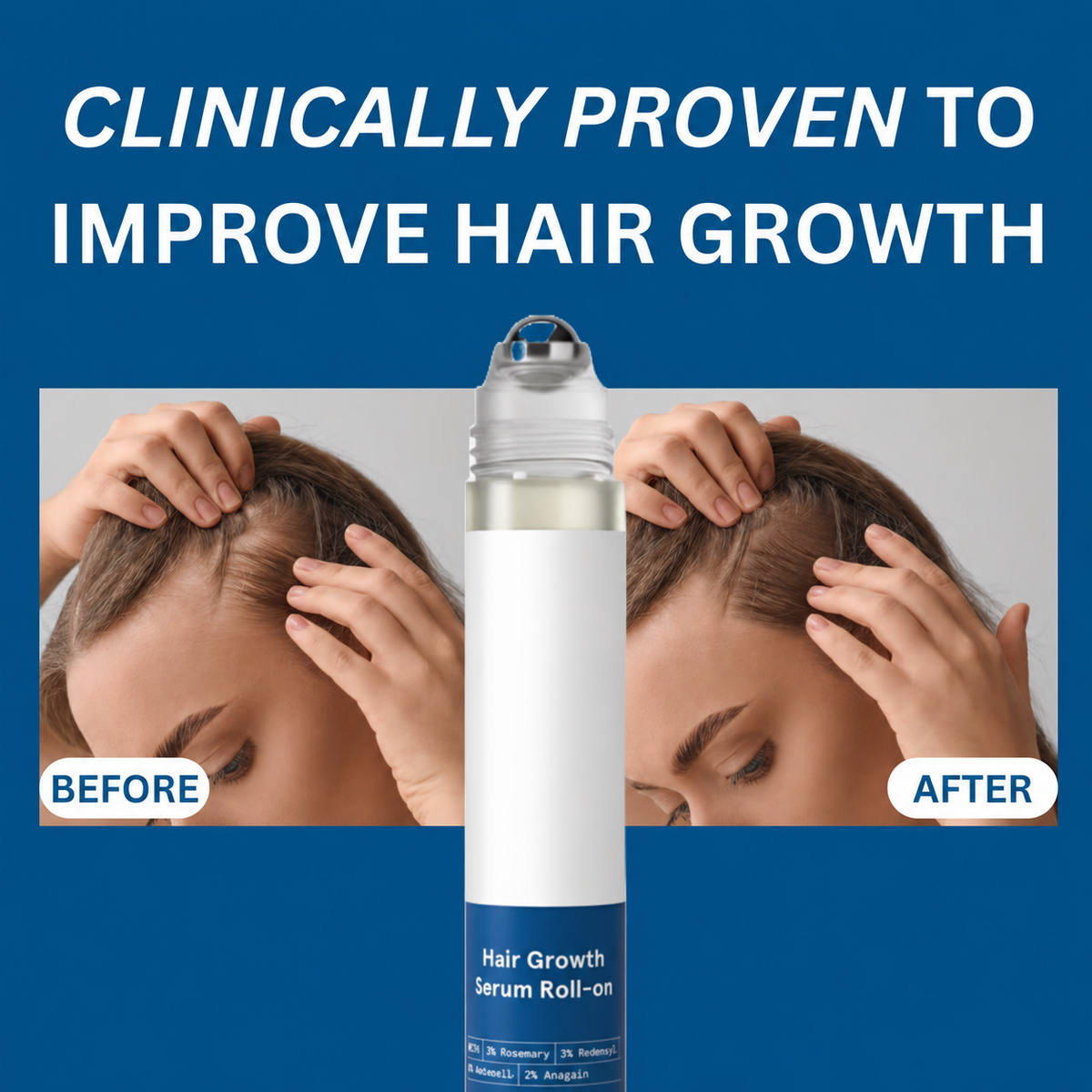 Hair Growth Roll