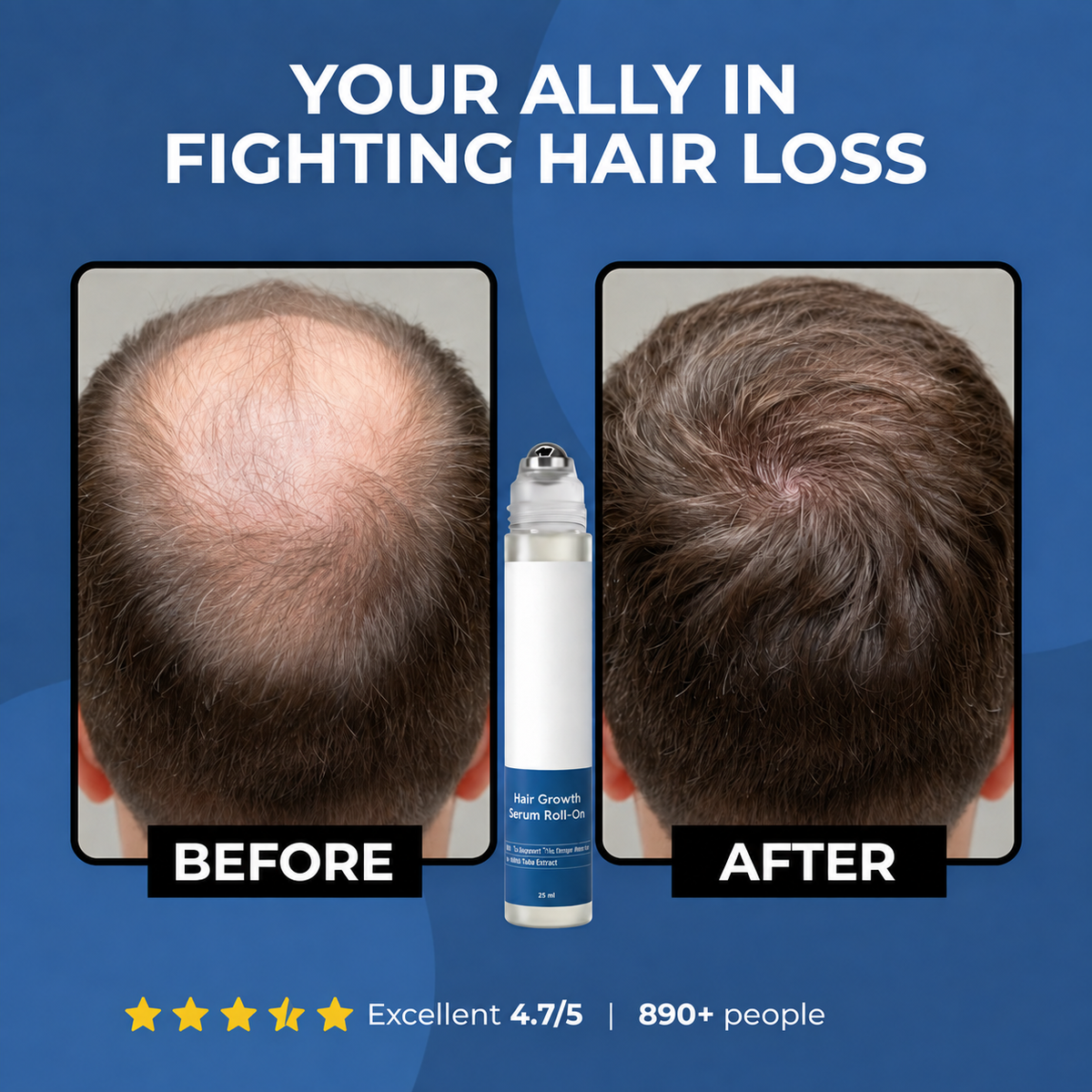 Hair Growth Roll